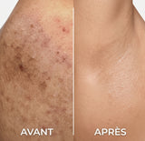 Gommage Intime Enzymatique — Anti-Imperfections